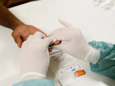Brasil fecha acordos de HIV, mas segue sem acesso à principal PrEP