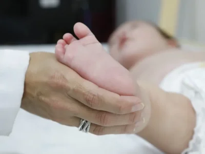 Atraso no teste do pezinho dificulta tratar AME no SUS